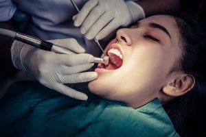 Best Dental Filling Clinic Egypt