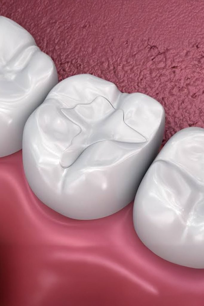 Best Dental Filling Clinic Egypt