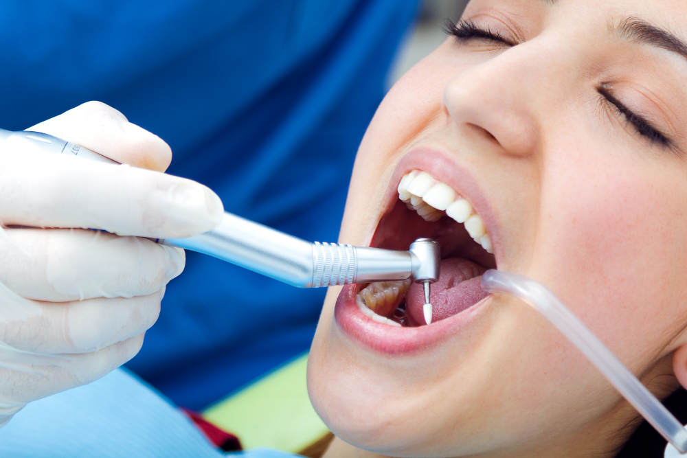 Dental Filling Clinic